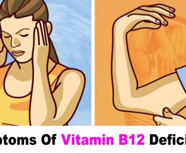 9 Signs And Symptoms Of Vitamin B12 Deficiency