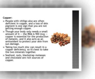 Nutrition and vitamins for Vitiligo