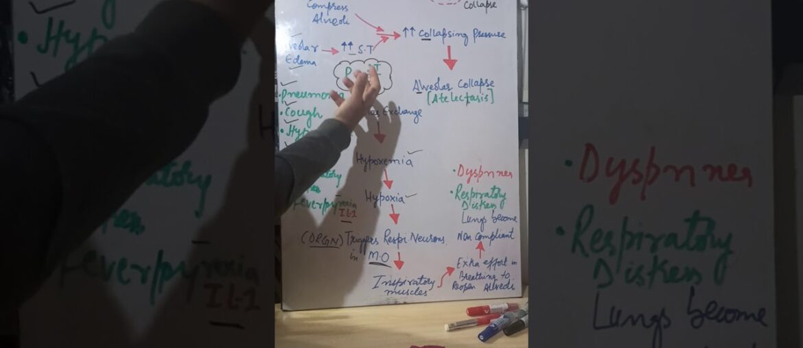 Immune system: Pathophysiology of COVID-19 part 2 by Irfan sir