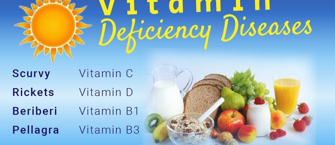 Vitamin Deficiency Diseases | English