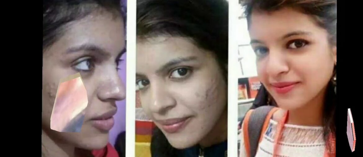 Herbalife Nutrition Hn skin booster HERBALIFE NUTRITION HN SKIN BOOSTER NUTRITION SKIN PRODUCTS