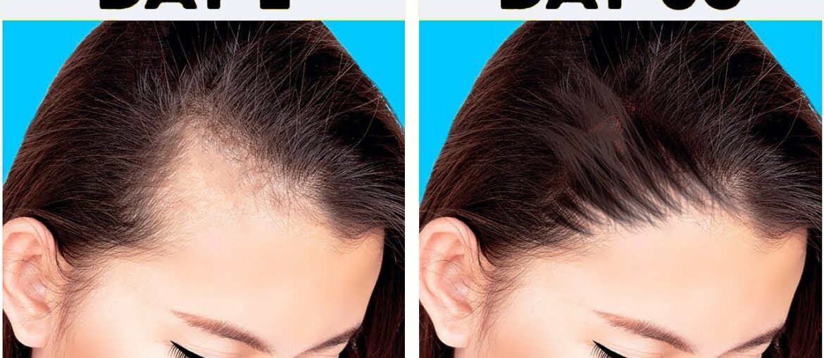 BANANA and VITAMIN E to have a Beautiful and HAIR GROWTH POWDER For Longer, Stronger Hair