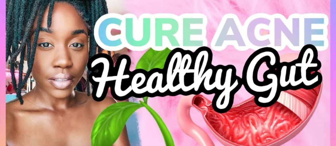 How To Cure Your Acne Naturally: Gut Health Tips | Shanese Danae