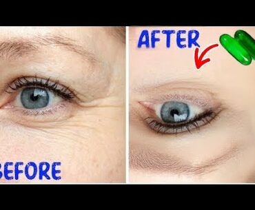 How To Get Rid Of Wrinkles | AMAZING BEAUTY HACKS WITH Vitamin E