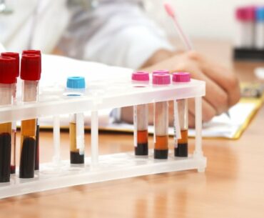 UPMC researchers developing coronavirus immunity test