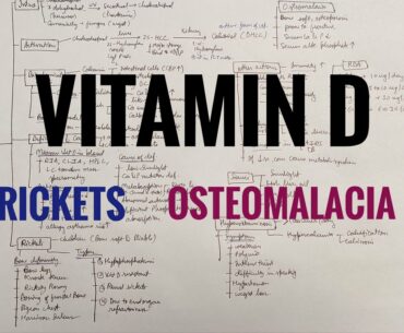 Vitamin D- Effects, diseases, deficiency, source, RDA,Rickets, osteomalacia