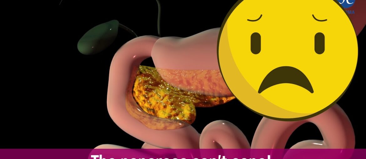 The Diabetes Drama - Sucontral Dietary Supplement - international