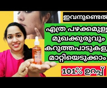 Vitamin C Serum For Face/Skin Care EP:7/Dr. rashel/