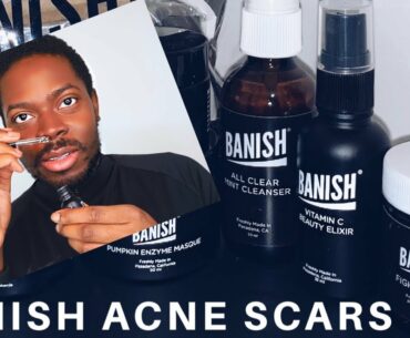 BANISH ACNE SCARS REVIEW | DOES IT WORK? THE HONEST TRUTH