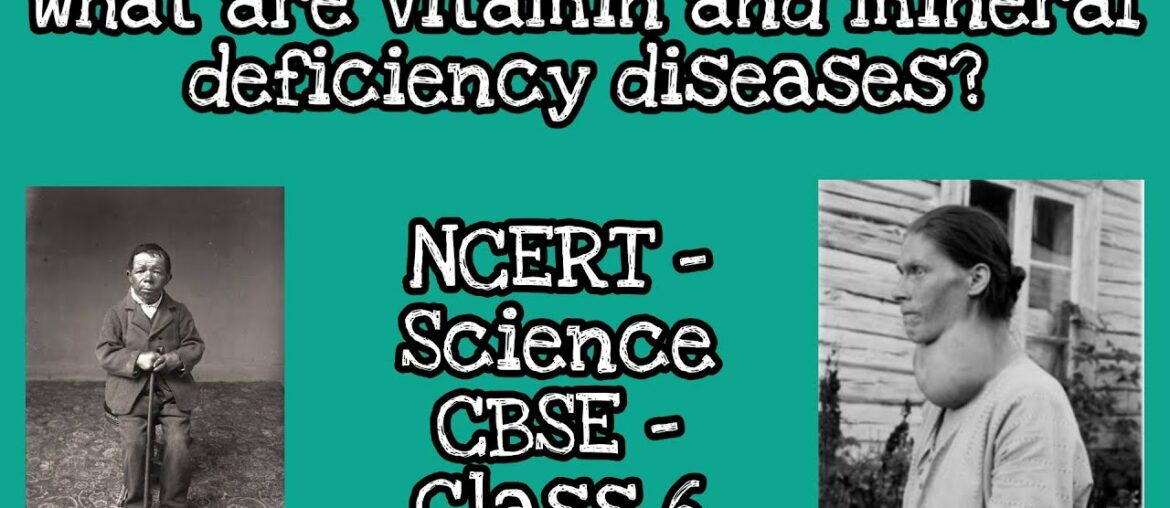 Components of food (Part-7) - Vitamin and Mineral deficiency diseases - Science NCERT class 6- CBSE