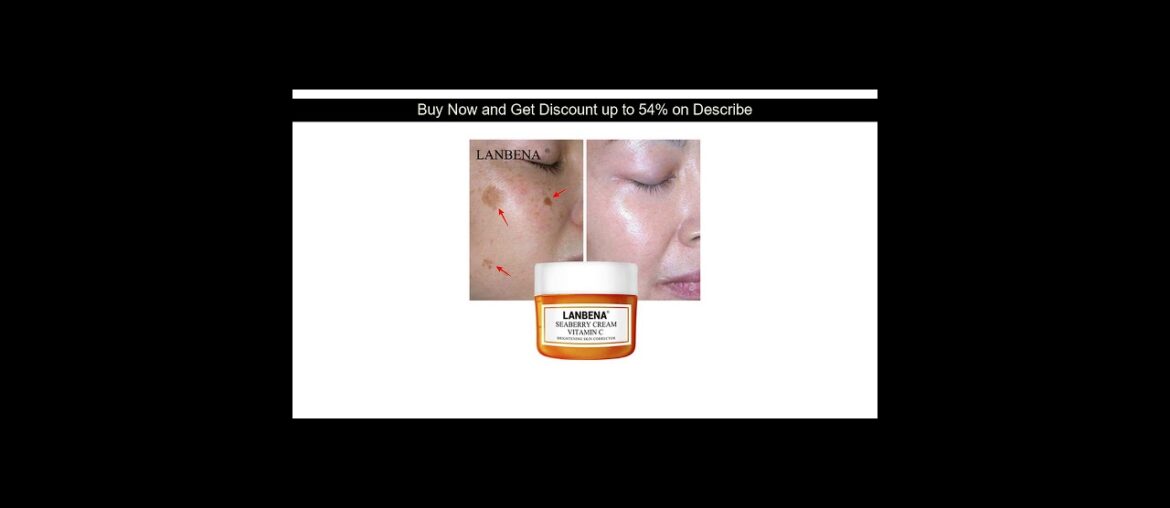 Original LANBENA Vitamin C Whitening Facial Cream Fade Freckles Remove Dark Spots Melanin Remover B