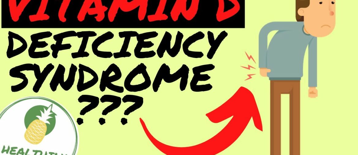 8 SURPRISING Signs You Lack Vitamin D!!