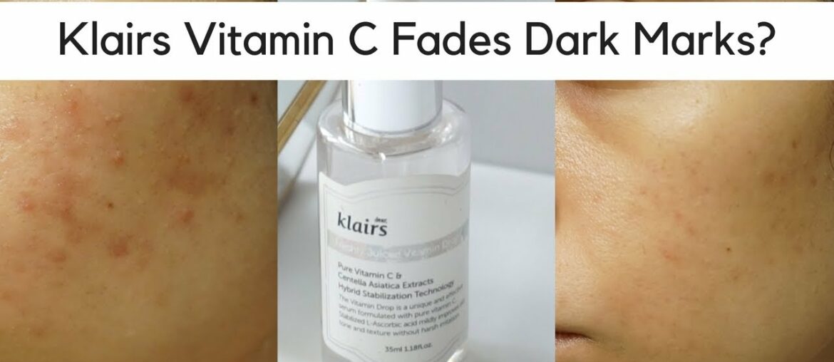 Klairs Freshly Juiced Vitamin C Review | Best Serum for Dark Marks?