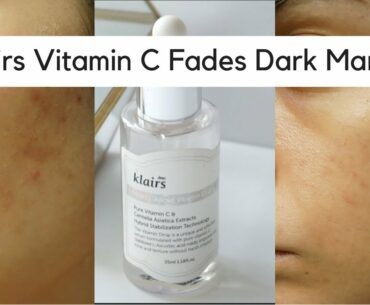 Klairs Freshly Juiced Vitamin C Review | Best Serum for Dark Marks?