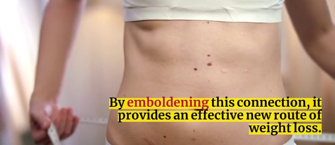 resurge review :  BE CAREFUL!!!!! Don't Buy This  Weight-loss Supplement  Up Until You  Enjoy...