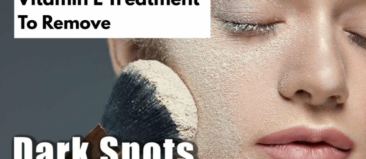 Vitamin E Treatment To Remove Dark Spots On Face