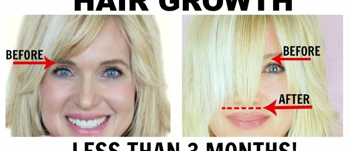 HAIR GROWTH SUPPLEMENTS! HAIR LOSS, THINNING HAIR, FAST GROWTH!