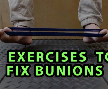 6 Exercises to Fix Bunions
