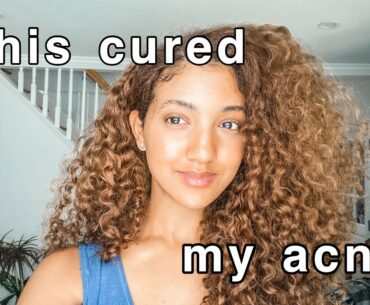 16 ways to treat acne naturally that don't involve drinking more water//vitamins, supplements, foods