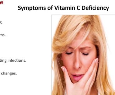 Symptoms of Vitamin C Deficiency