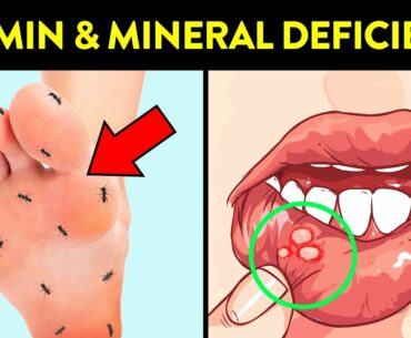 6 Signs That You May Have Vitamin And Mineral Deficiency