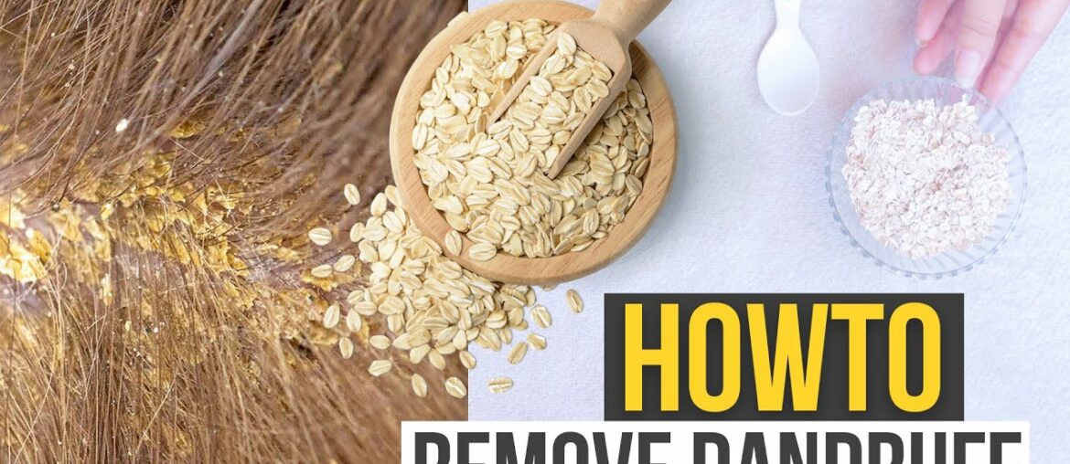 HOW TO REMOVE HAIR  DANDRUFF & DRY SKIN - Beauty Tips -how to make hair grow faster- HOW TO MAKE IT