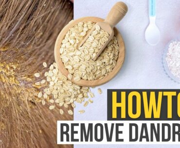 HOW TO REMOVE HAIR  DANDRUFF & DRY SKIN - Beauty Tips -how to make hair grow faster- HOW TO MAKE IT