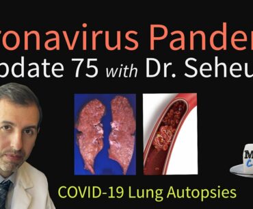 Coronavirus Pandemic Update 75: COVID-19 Lung Autopsies - New Data
