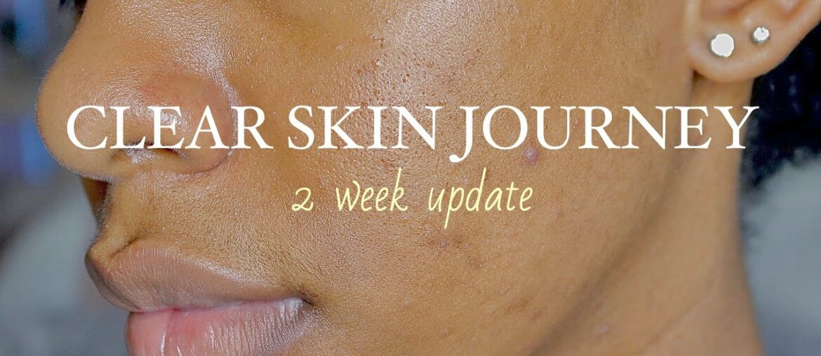 CLEAR SKIN JOURNEY I Vitamins for 30 Days I 2 Week UPDATE (WITH PICTURES)