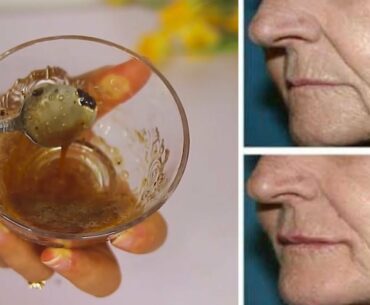 GET RID OF DEEP MOUTH WRINKLES VERY FAST