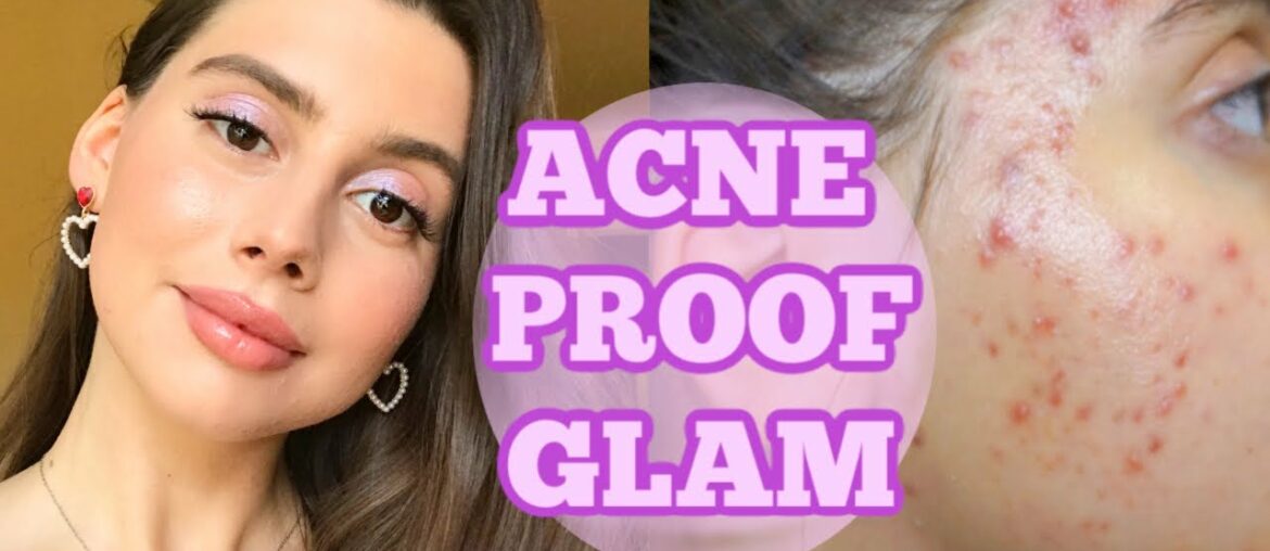 ACNE PROOF NATURAL GLAM MAKEUP || Lets CHIT CHAT self doubt, unmotivated during this time!