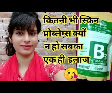Niacinamide vitamin B3 for clear & spotless beautiful skin | Brijwasi Girl