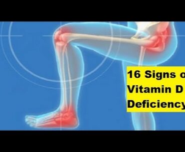 16 Signs of Vitamin D Deficiency | Signs of Vitamin D Deficiency