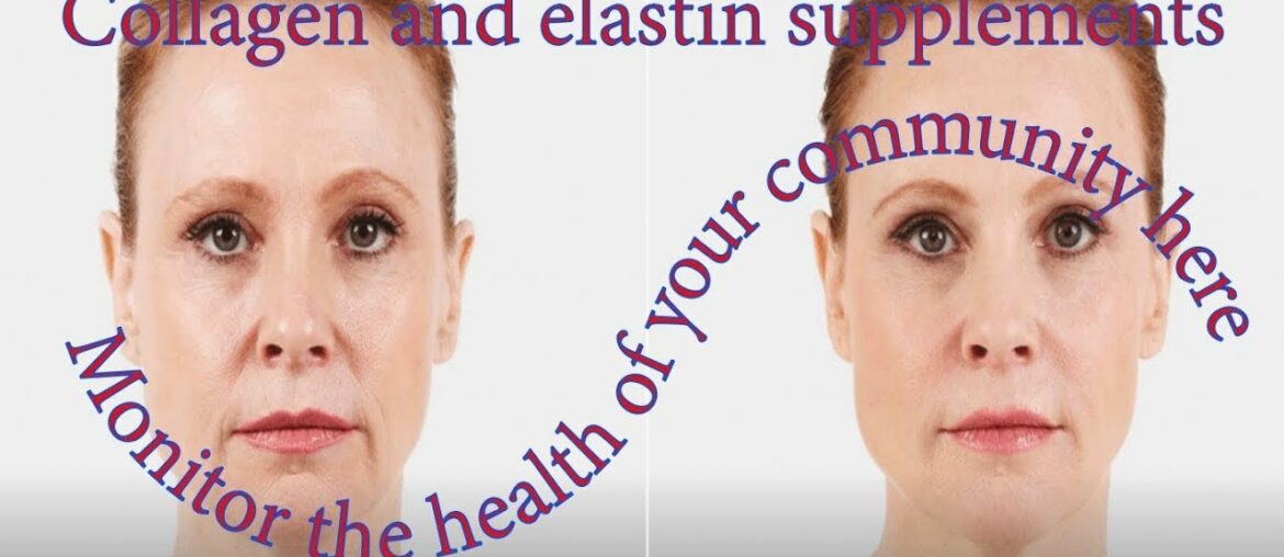 Collagen and elastin supplements. Monitor the health of your community here