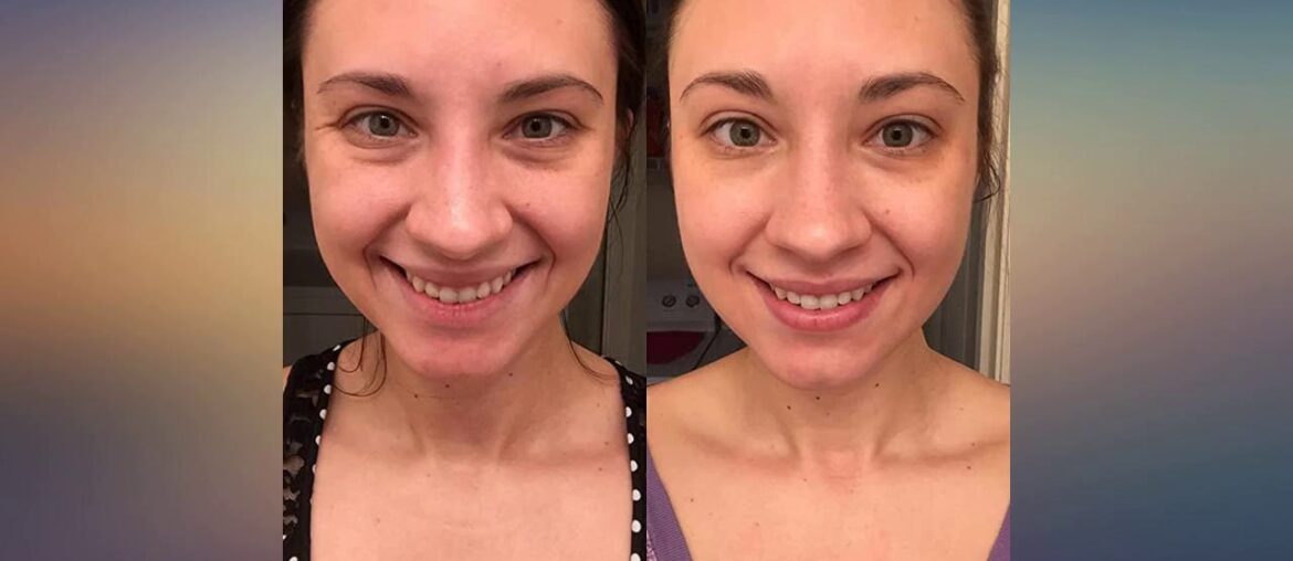 TruSkin Vitamin C Serum for Face, Topical Facial Serum with Hyaluronic Acid, Vitamin E, 1