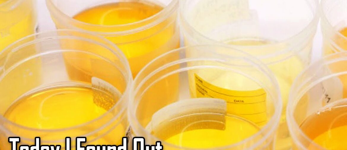 Why Do Vitamins Make Urine Bright Yellow