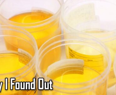 Why Do Vitamins Make Urine Bright Yellow