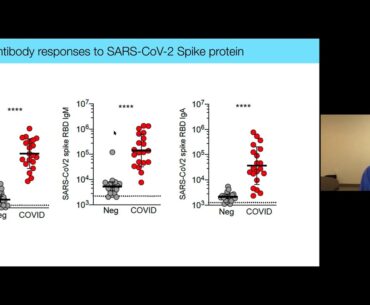 Shane Crotty, COVID-19 Virtual Symposium: May 27, 2020