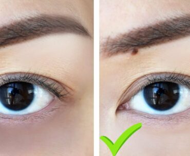 HOW TO: Get Rid Of Dark Circles WITHOUT MAKEUP!