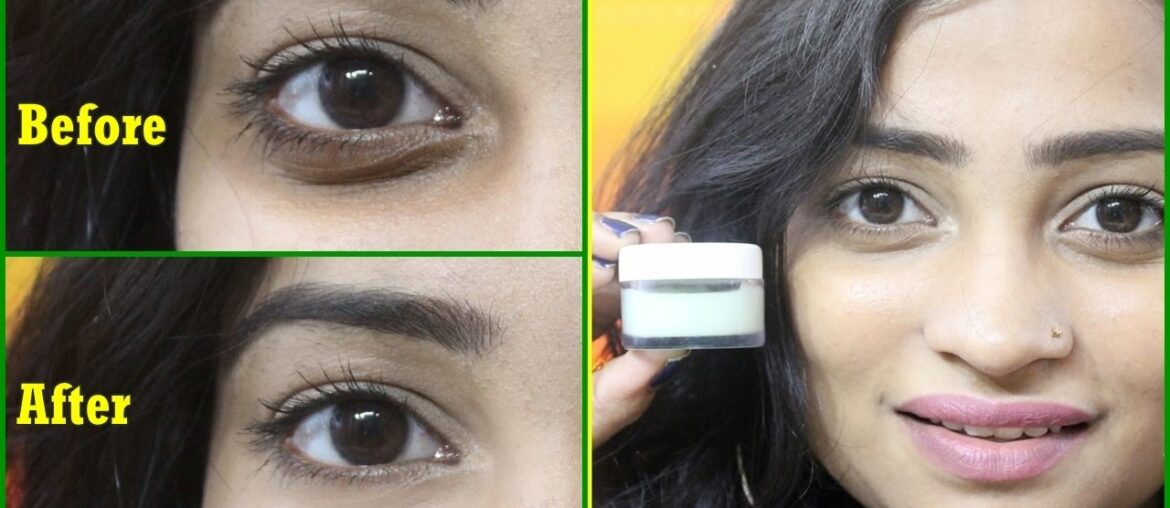 Homemade UNDER EYE CREAM to Remove DARK CIRCLES, Wrinkles | 100% Effective Natural UNDER EYE GEL