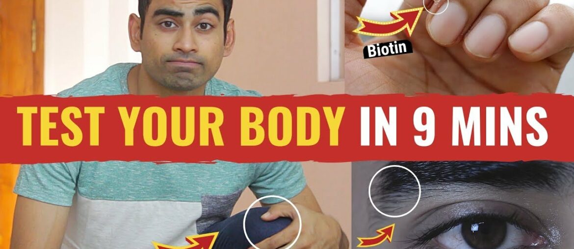 28 Signs Your Body is Deficient in Vital Nutrients (With Solution)