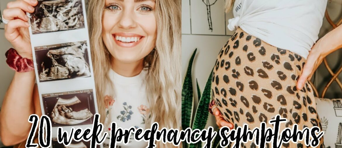 20 WEEK PREGNANCY UPDATE|| ANATOMY SCAN|| WEIGHT GAIN|| SUPPLEMENTS I AM TAKING|| HAYLEY JANNISE