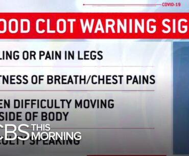 Doctors warn of potentially deadly blood clots in COVID-19 patients