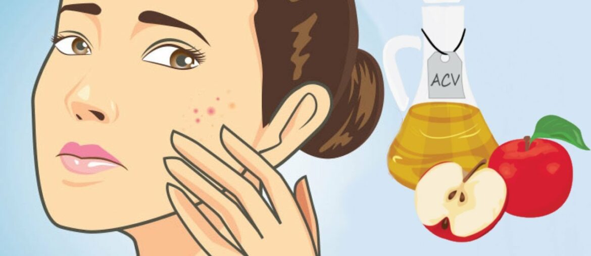 8 Surprising Beauty Benefits of Apple Cider Vinegar