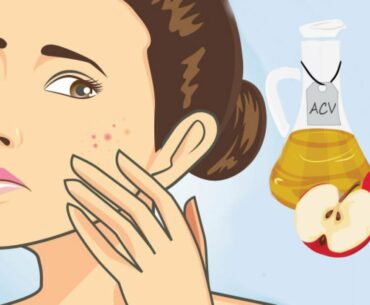 8 Surprising Beauty Benefits of Apple Cider Vinegar
