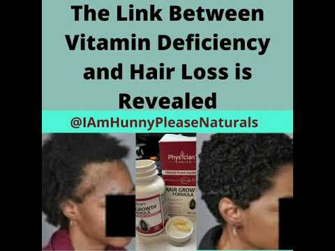 The Link Between Vitamin Deficiency and Hair Loss is Revealed