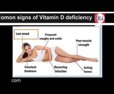 Vitamin D deficiency , Common symptoms and signs