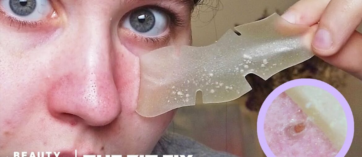 Overnight Pore Strips Absorb Excess Sebum | The Zit Fix
