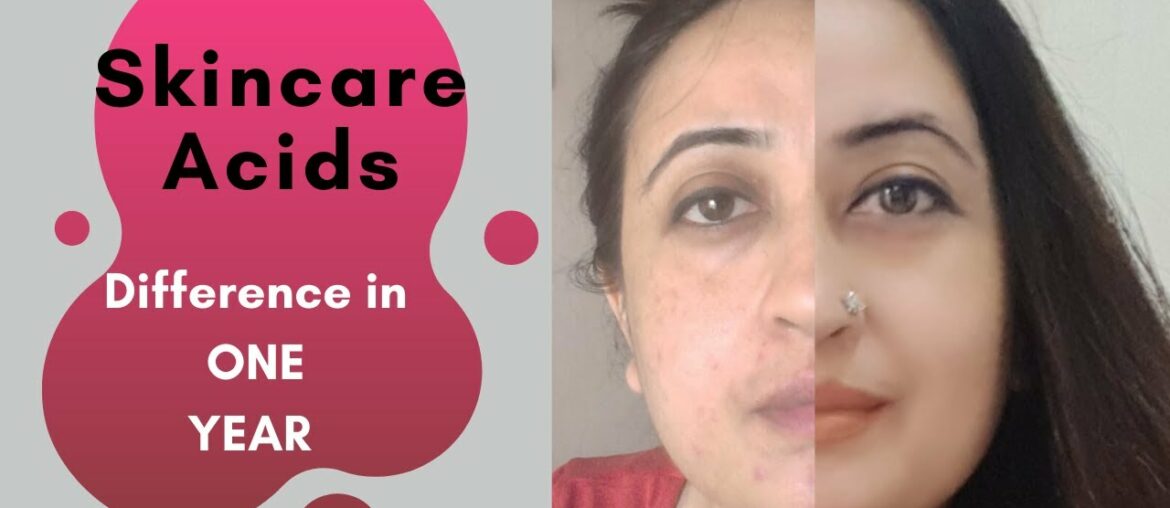 Glycolic Acids Plus 6 Skincare Acids | How to Use Acids in Skincare Routine |Anti-aging, fading scar