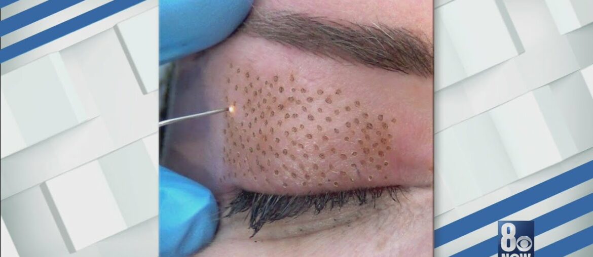 Tighten skin around your eyes with VJazzy Wellness